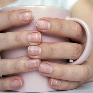 These 5 Unevident Signs of Nutrient Gaps Can Be Stealing Your Glow