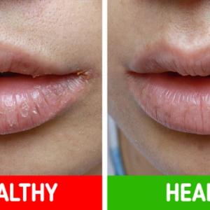 7 Warning Signs Your Body Might Be Revealing Health Issues 7 Warning Signs Your Body Might Be Revealing Health Issues