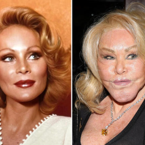 Hollywood’s Cosmetic Evolution: How Celebrities Redefine Beauty and Build Empires Hollywood’s Cosmetic Evolution: How Celebrities Redefine Beauty and Build Empires