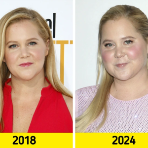 Amy Schumer Credits Internet Trolls for Leading to Life-Changing Health Diagnosis