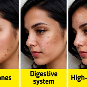 8 Skin Red Flags That Could Be Warning You About Your Health