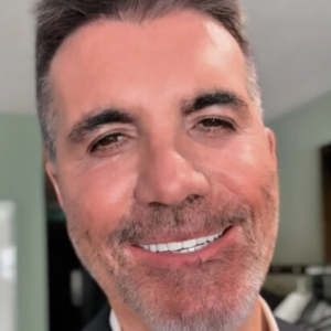 What Happened to His Face?!” Simon Cowell’s Drastic New Look Leaves Fans Concerned What Happened to His Face?!” Simon Cowell’s Drastic New Look Leaves Fans Concerned