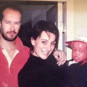 Couple Adopts a Red-Skinned Baby Everyone Thought Wouldn’t Survive—She Grew Into a Fighter and a Champion