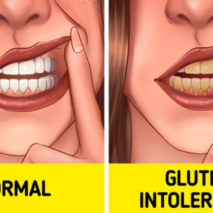 11 Surprising Signs Your Body Might Be Sensitive to Gluten 11 Surprising Signs Your Body Might Be Sensitive to Gluten