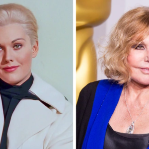 13 Stars Whose Looks Have Dramatically Changed After Cosmetic Enhancements