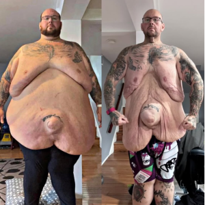 From 635 Pounds to Fighting Fit: Pete Brennan’s Unbelievable Weight Loss Transformation