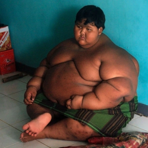 From Burdened to Brave: Arya Permana’s Shocking 238-Pound Transformation That Inspired the World